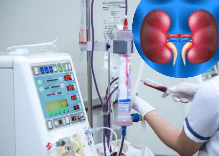 Hemodialysis Access Care