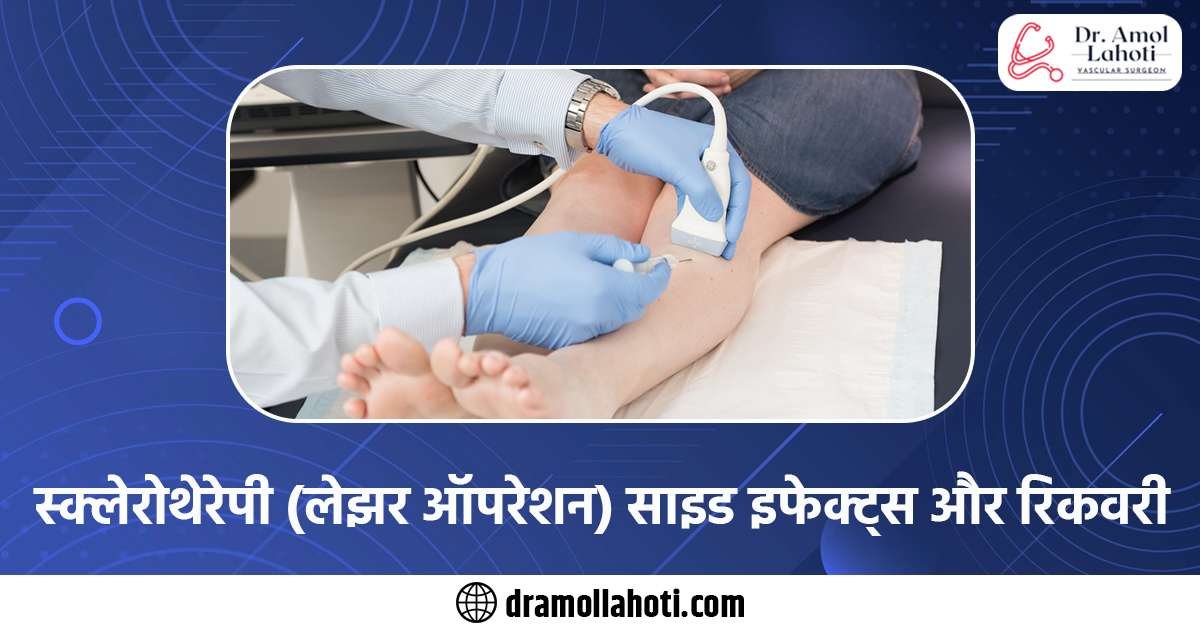 डीप वेन थ्रोम्बोसिस क्या है? गुठलिया याने गाठी DVT (deep venous thrombosis)