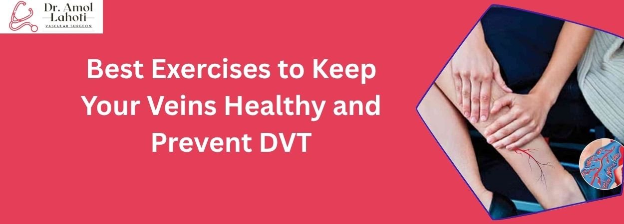 Best Exercises to Keep Your Veins Healthy and Prevent DVT