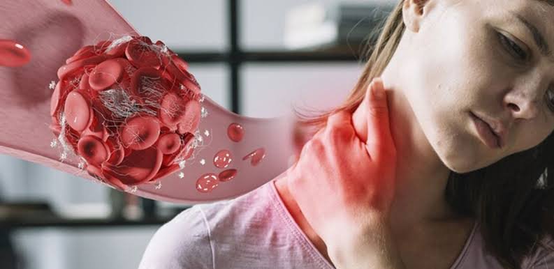 Can a Blocked Neck Artery Be Treated Without Open Surgery? What You Need to Know